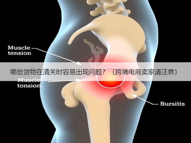 哪些货物在清关时容易出现问题？（跨境电商卖家请注意）(图3)